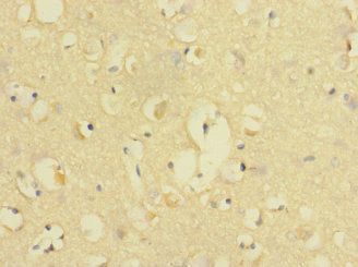 CD226 Antibody