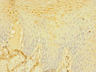 CD226 Antibody