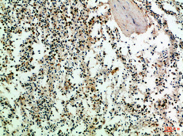 CD247 Antibody
