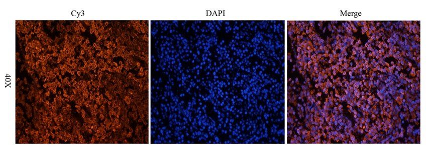 CD25 Rabbit Polyclonal Antibody