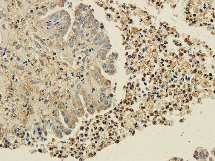 CD25 Rabbit Polyclonal Antibody