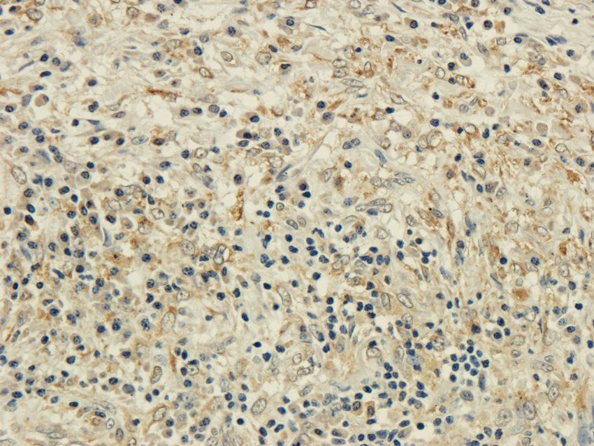 CD25 Rabbit Polyclonal Antibody
