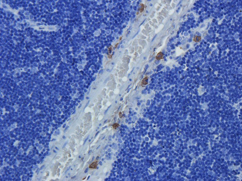 CD274 Rabbit Polyclonal Antibody