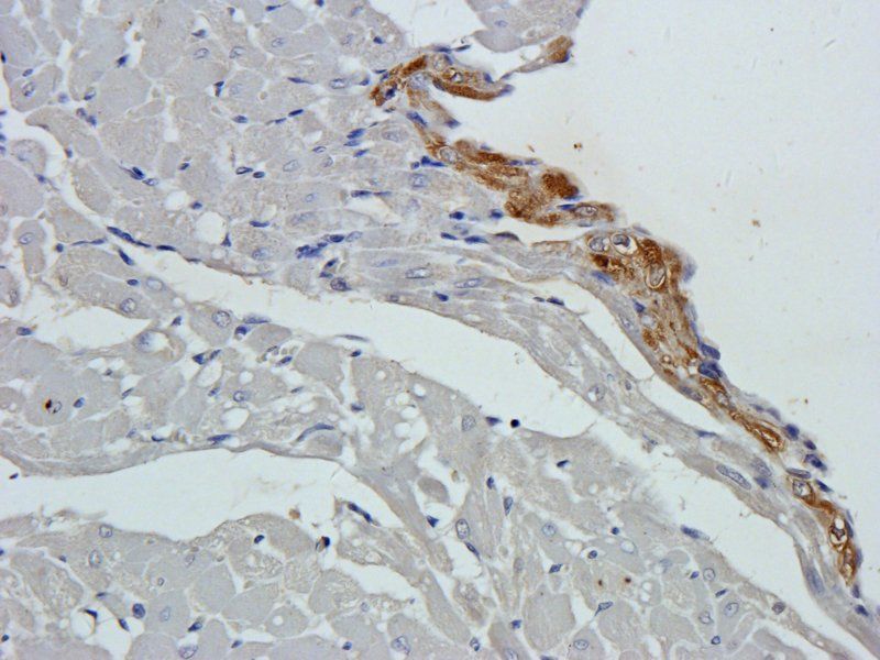 CD274 Rabbit Polyclonal Antibody