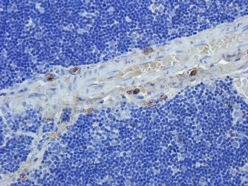 CD274 Rabbit Polyclonal Antibody