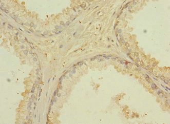 CD276 Antibody