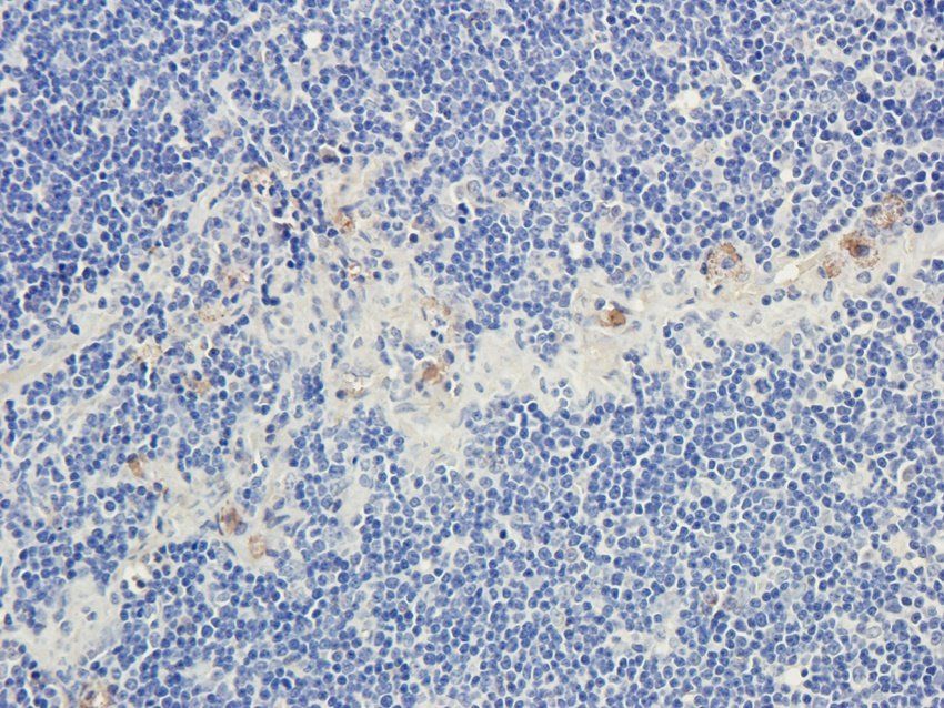 CD28 Rabbit Polyclonal Antibody