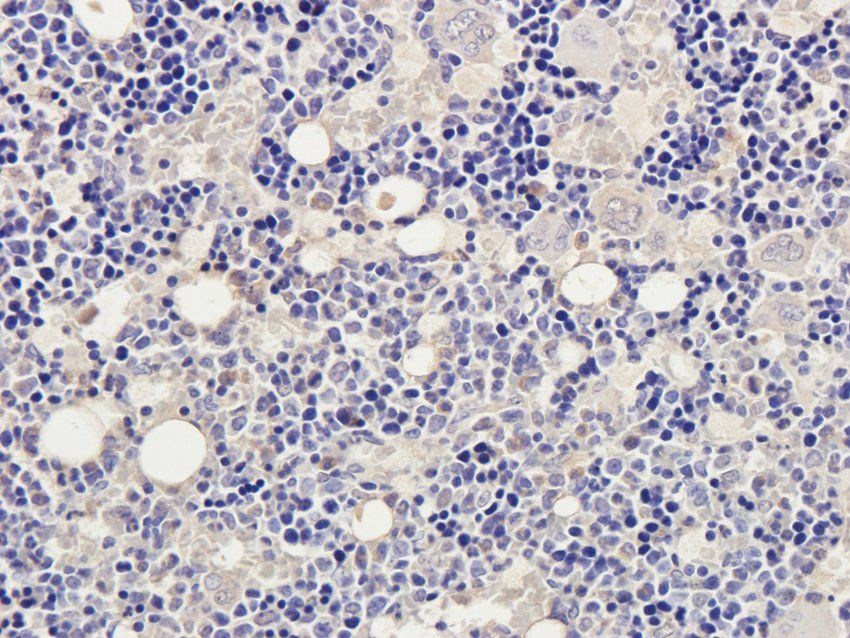 CD28 Rabbit Polyclonal Antibody