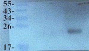CD303 Rabbit Polyclonal Antibody