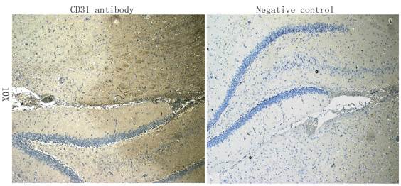 CD31 Rabbit Polyclonal Antibody