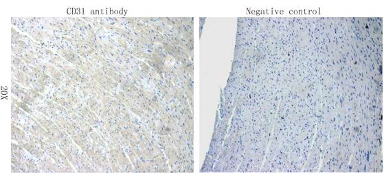 CD31 Rabbit Polyclonal Antibody