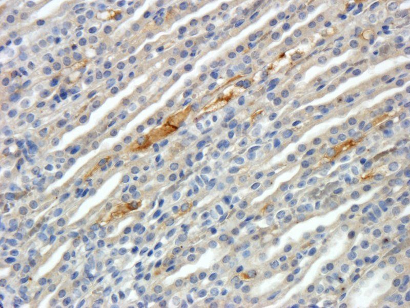 CD31 Rabbit Polyclonal Antibody