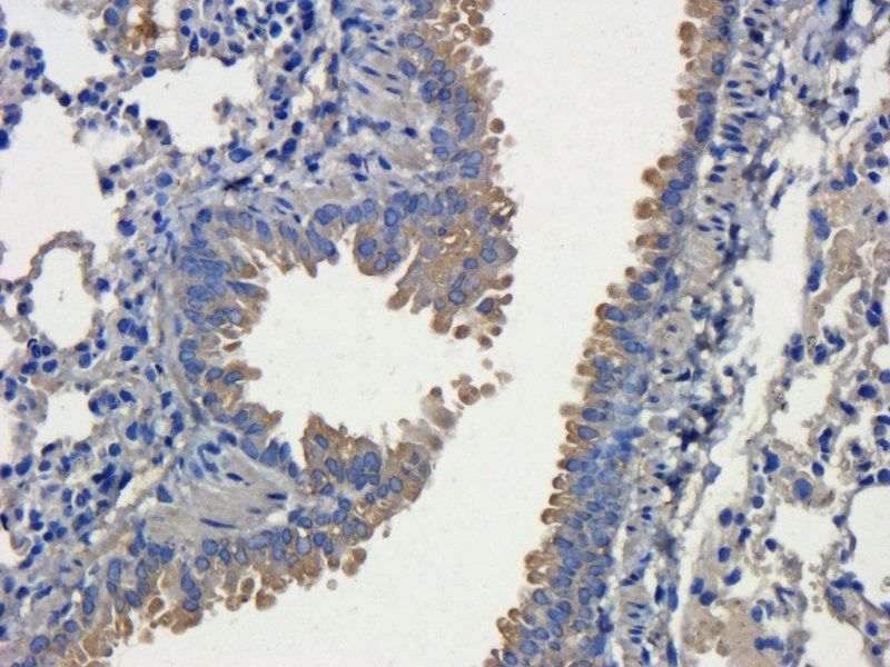 CD31 Rabbit Polyclonal Antibody