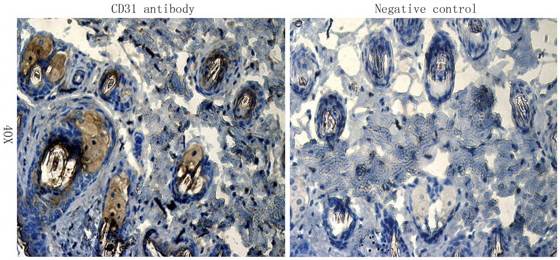 CD31 Rabbit Polyclonal Antibody