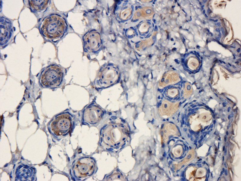 CD31 Rabbit Polyclonal Antibody