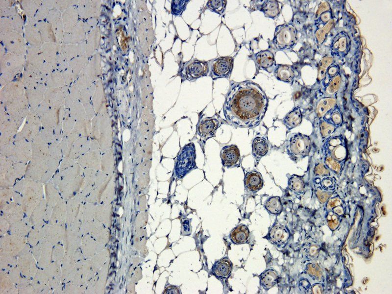 CD31 Rabbit Polyclonal Antibody