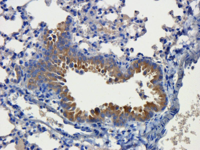 CD31 Rabbit Polyclonal Antibody