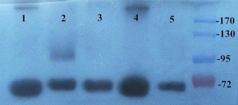 CD31 Rabbit Polyclonal Antibody