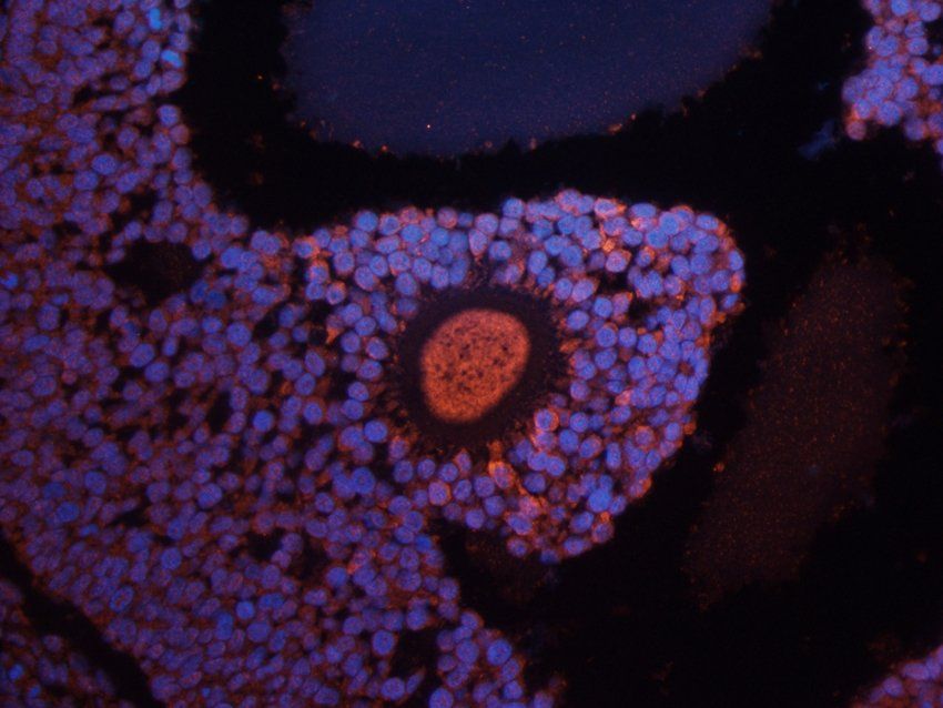CD333 Rabbit Polyclonal Antibody