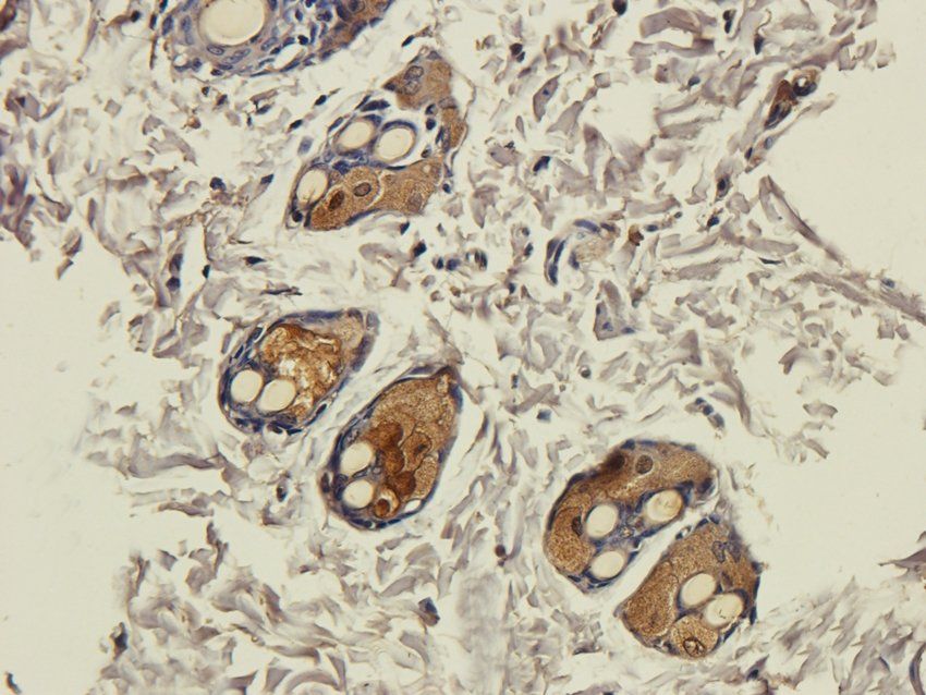 CD333 Rabbit Polyclonal Antibody