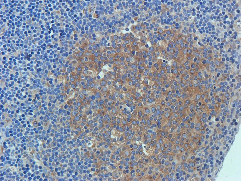 CD34 Rabbit Polyclonal Antibody