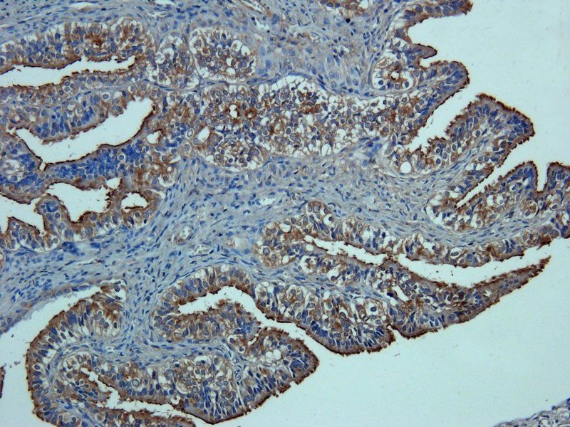 CD34 Rabbit Polyclonal Antibody