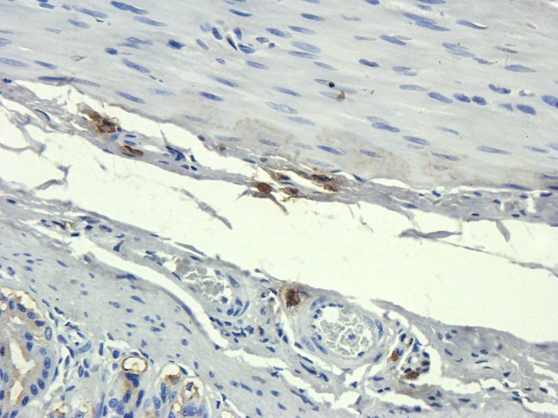 CD35 Rabbit Polyclonal Antibody