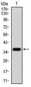 CD36 Antibody