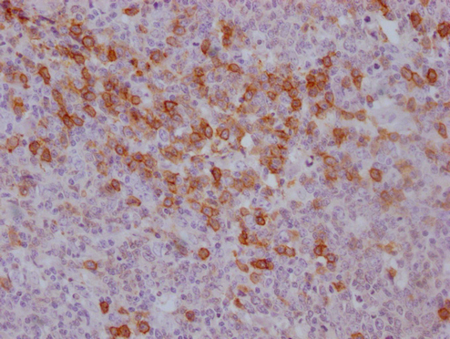CD38 Antibody