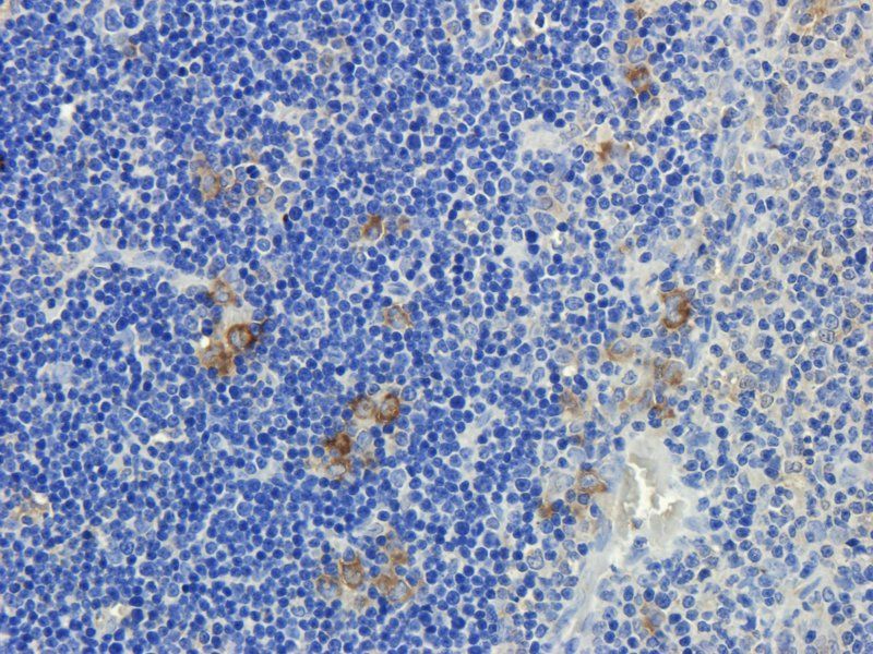 CD3 Rabbit Polyclonal Antibody