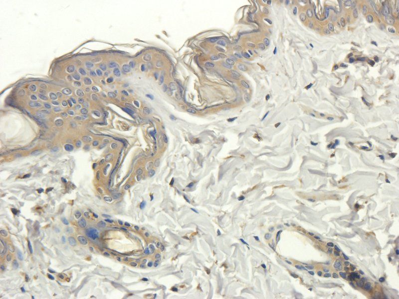 CD3 Rabbit Polyclonal Antibody