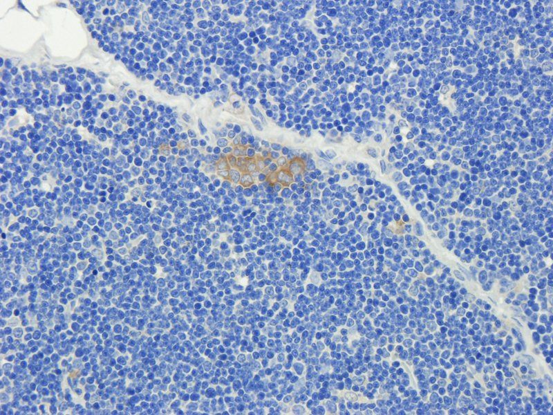 CD3 Rabbit Polyclonal Antibody
