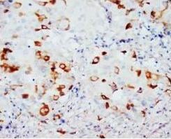 CD40L/CD40LG Rabbit Polyclonal Antibody