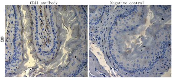 CD41 Rabbit Polyclonal Antibody