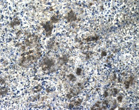 CD41 Rabbit Polyclonal Antibody