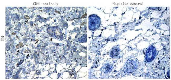 CD41 Rabbit Polyclonal Antibody