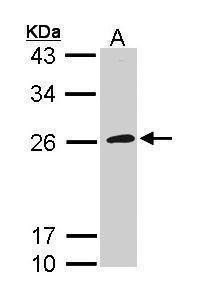 Annexin A1 Rabbit Polyclonal Antibody