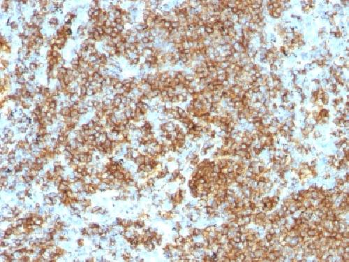 PTPRC Antibody