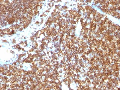 PTPRC Antibody