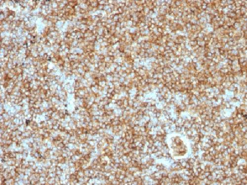 PTPRC Antibody