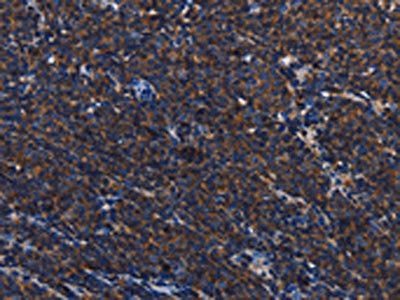PTPRC Antibody