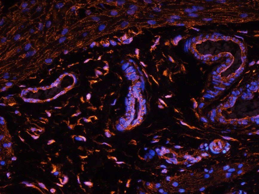 CD47 Rabbit Polyclonal Antibody