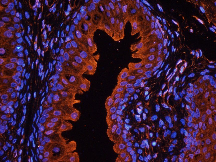 CD47 Rabbit Polyclonal Antibody