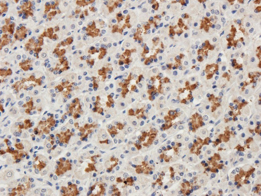 CD47 Rabbit Polyclonal Antibody