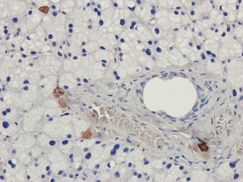 CD47 Rabbit Polyclonal Antibody