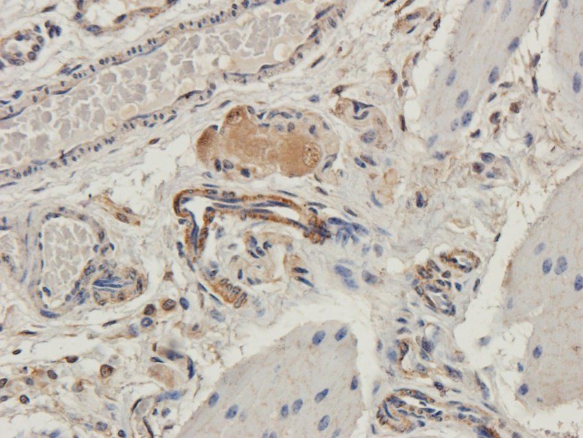 CD47 Rabbit Polyclonal Antibody