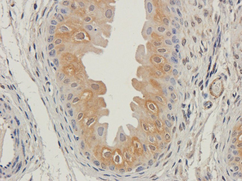 CD47 Rabbit Polyclonal Antibody