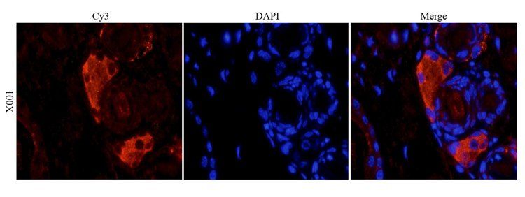 CD4 Rabbit Polyclonal Antibody