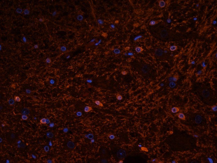CD57 Rabbit Polyclonal Antibody