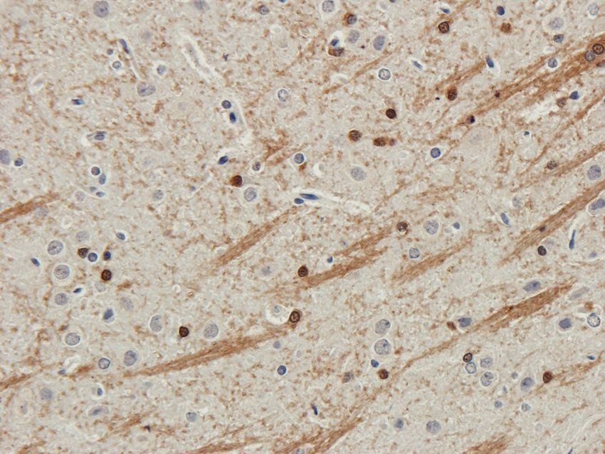 CD57 Rabbit Polyclonal Antibody